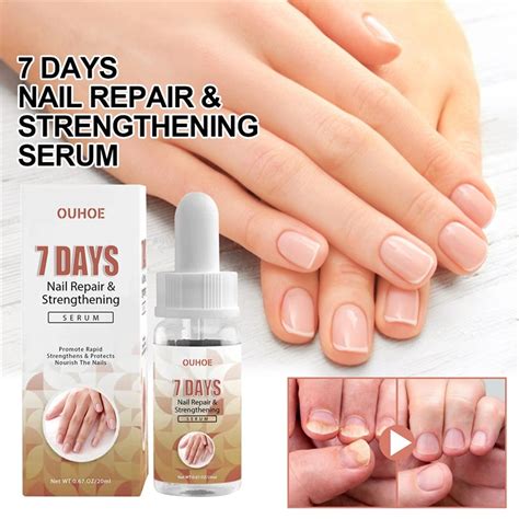 fingernail strengthening serum.